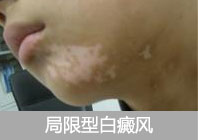 什么是皮肤镜 01.jpg