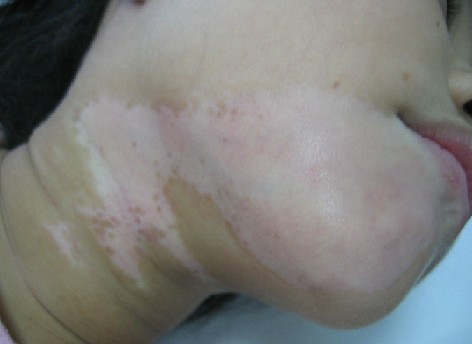 写给白癜风患者的一封信 37821394526026.jpg